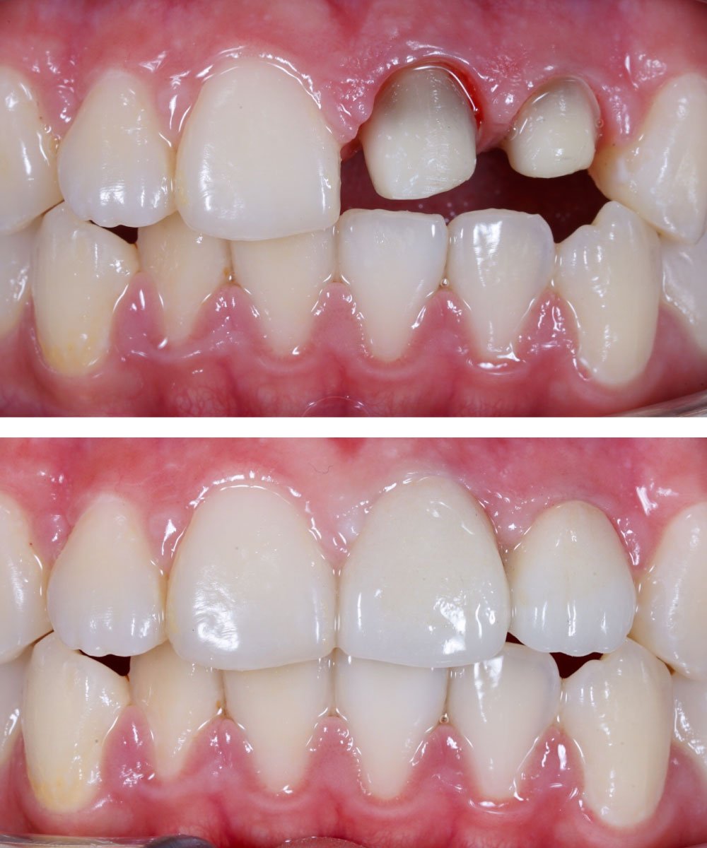 Sammamish Kids Dentist Office