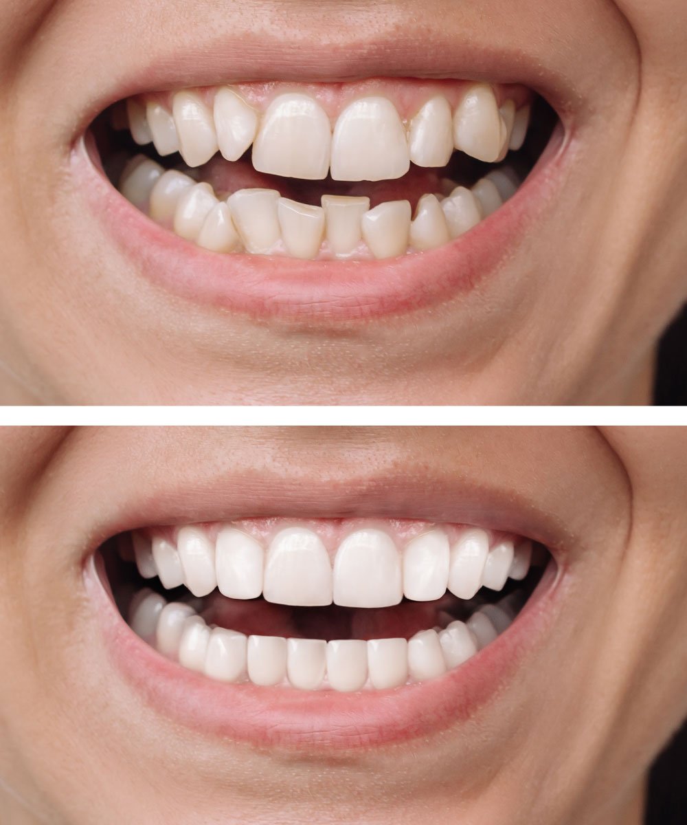 Sammamish Kids Dentist Office