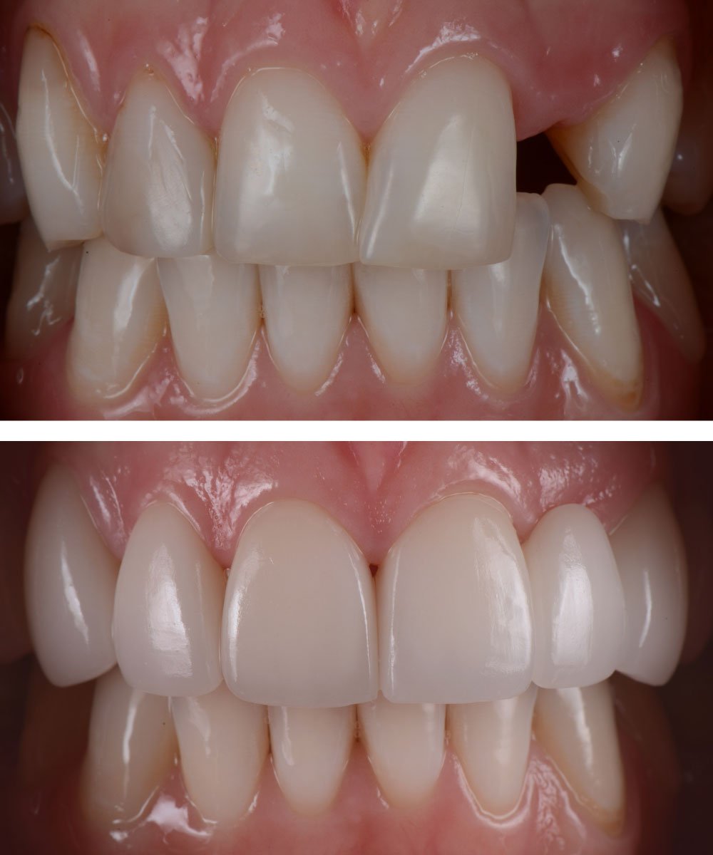 Sammamish Kids Dentist Office