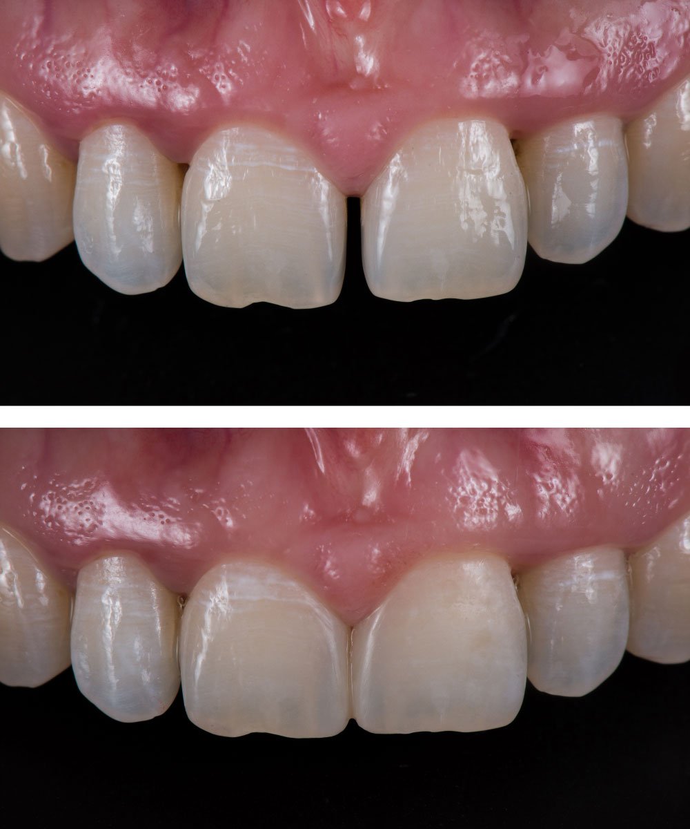 Sammamish Kids Dentist Office