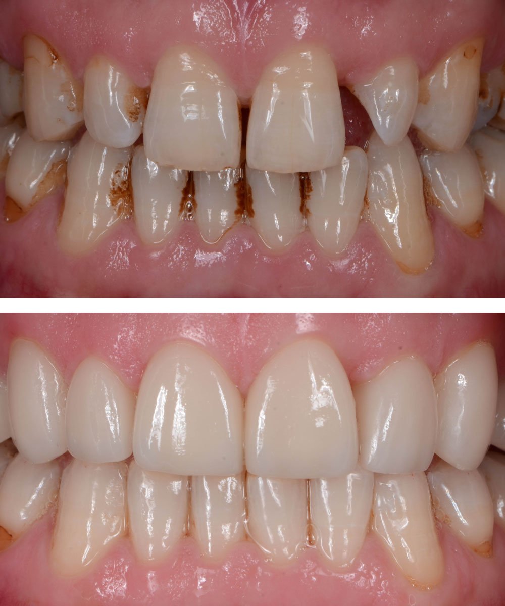 Sammamish Kids Dentist Office