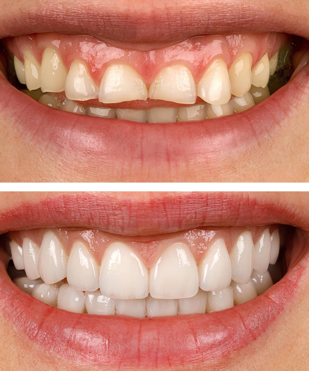 Sammamish Kids Dentist Office