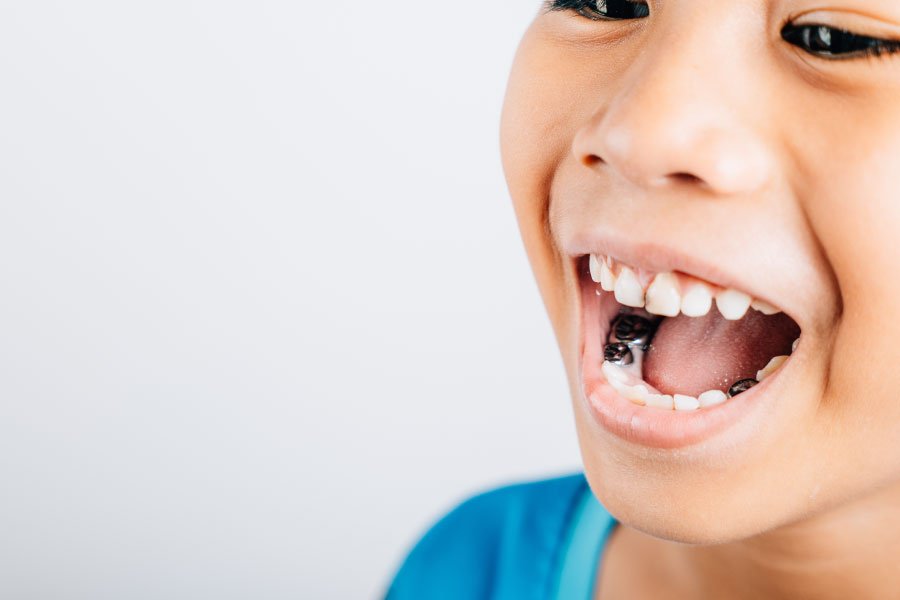 Sammamish Hall Dental Crowns